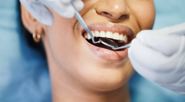 Best Emergency Dentist for Knocked-Out Tooth in Orchard City, CO